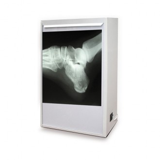 NEGATOSCOPIO Estándar...