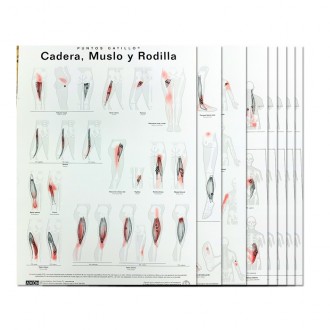 Lámina Puntos Gatillo...